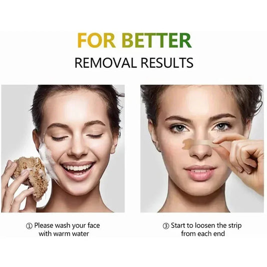 Lumière BreatheEasy™ Nasal Strips
